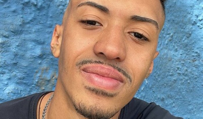 Ajude o Bruno A Reconstruir Sua Vida