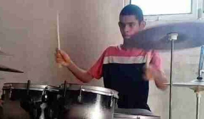 Kit de Pratos Novos de Bateria