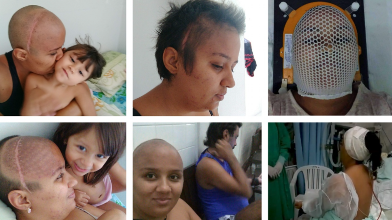Levanta minha auto estima depois do câncer 