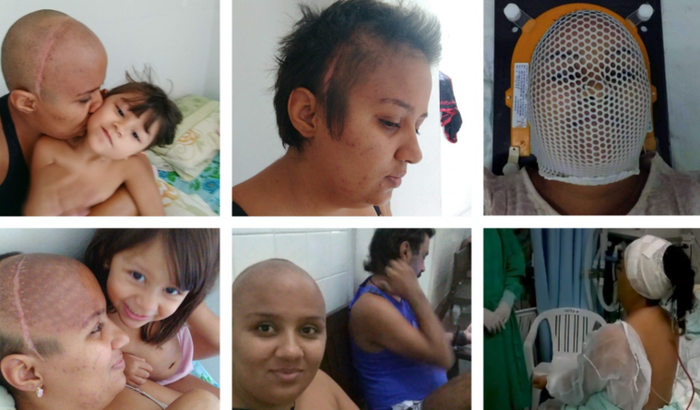 Levanta minha auto estima depois do câncer