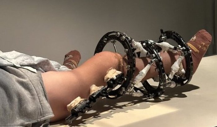 Ajude no tratamento Cirúrgico da Sarah