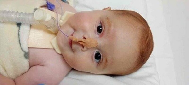 Cure o Theo da AME TIPO 1