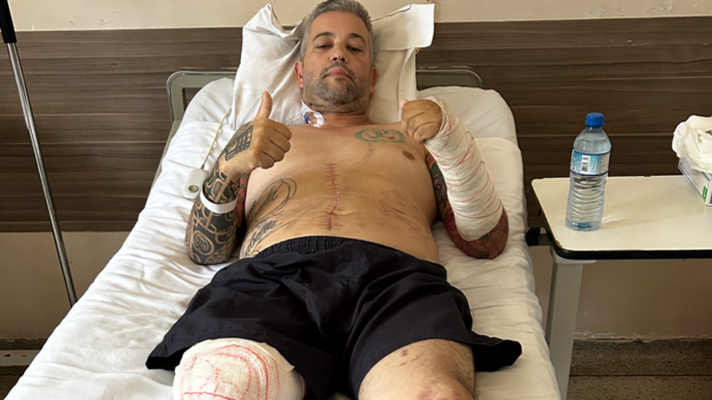 Ajuda para comprar a prótese do Rocha 