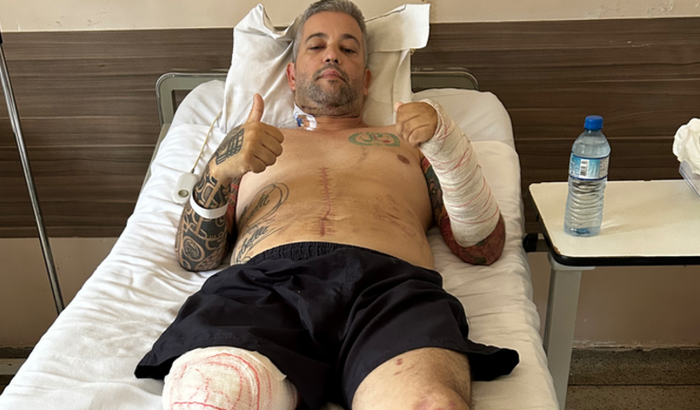 Ajuda para comprar a prótese do Rocha 