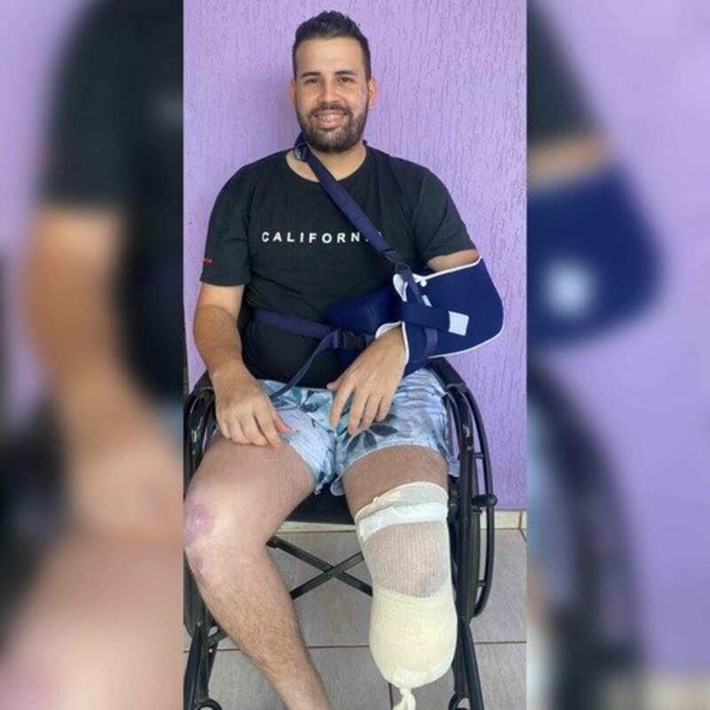 AJUDA PARA A AQUISIÇÃO DE UMA PRÓTESE