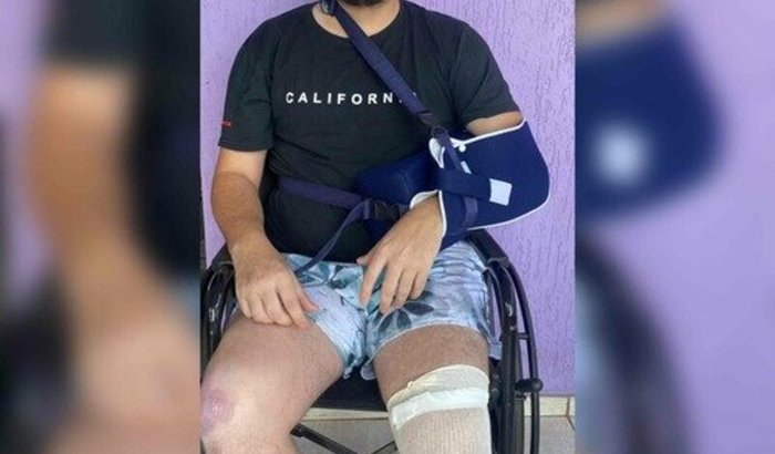 AJUDA PARA A AQUISIÇÃO DE UMA PRÓTESE