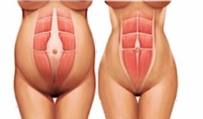 CIRURGIA