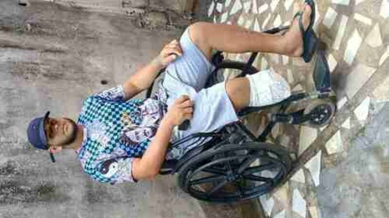 Ajuda pra comprar minha prótese da minha perna 