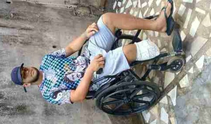 Ajuda pra comprar minha prótese da minha perna 