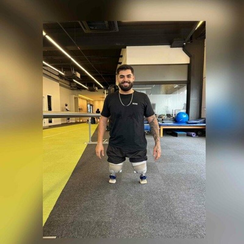 Ajude o Guilherme a conquistar suas próteses e recuperar sua qualidade de vida.