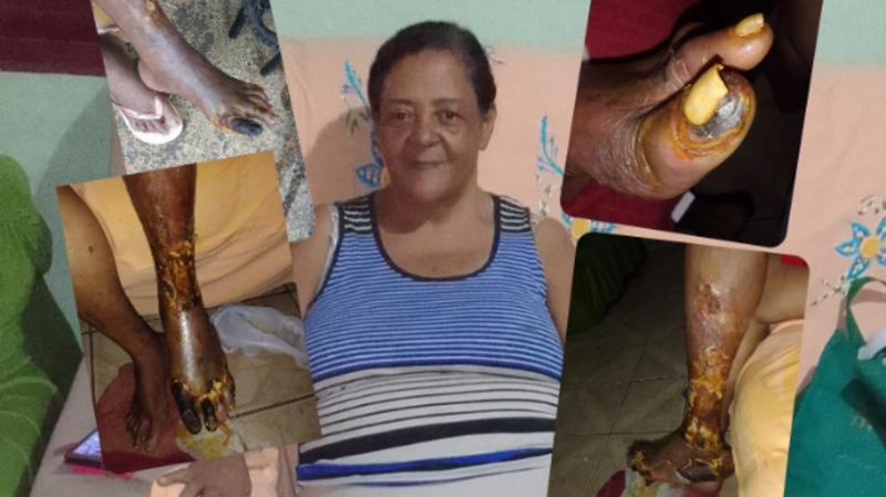 Cirurgia da Tia Rosa 