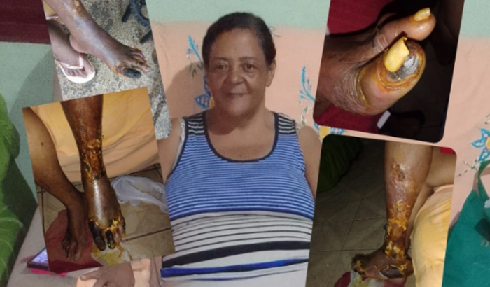 Cirurgia da Tia Rosa