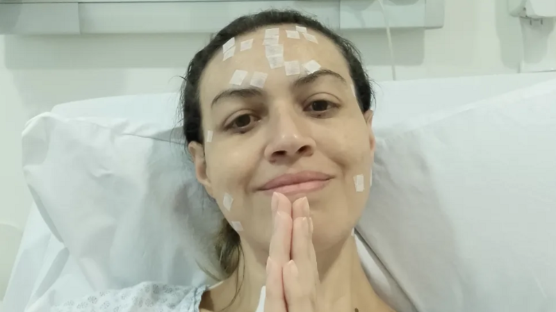 Tratamento Neurológico para Neuralgia do Trigêmeo e Distonia 