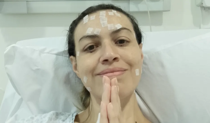 Tratamento Neurológico para Neuralgia do Trigêmeo e Distonia