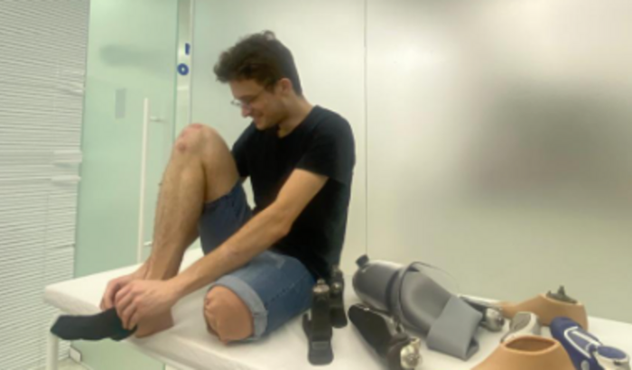 Perna Nova para Nosso Pirata - Prótese