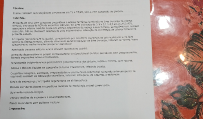 Necrose Avascular femoral  nas duas pernas  preciso fazer cirurgia. 