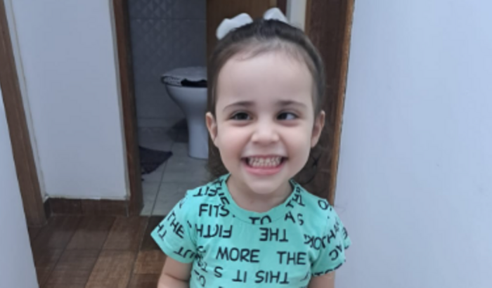 Cirurgia Estrabismo Manuela