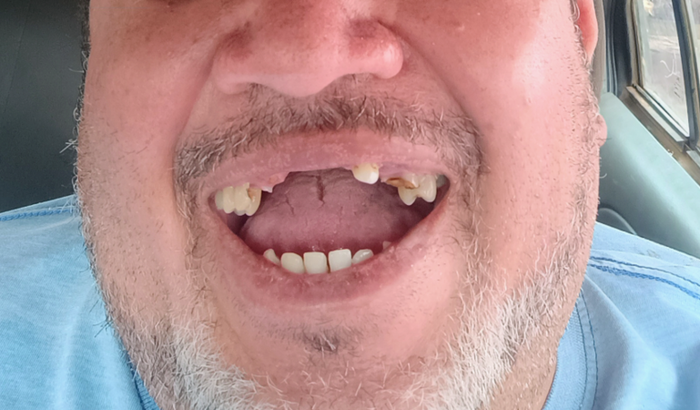 Arrumar os dentes