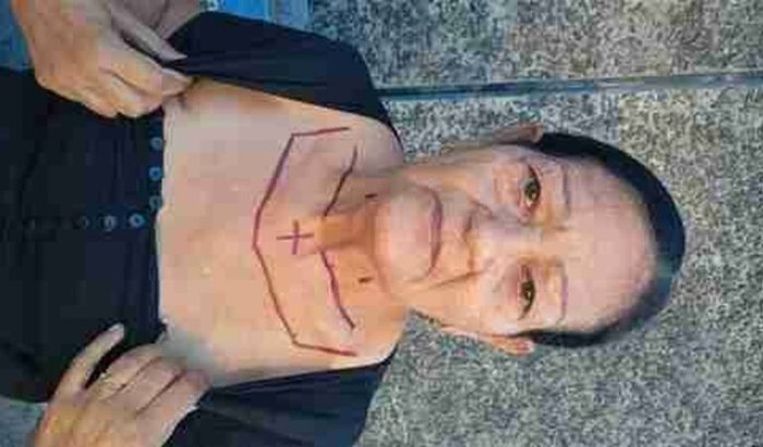 Ajudar no tratamento de Dona Aracy Esteves 