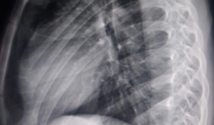 Cirurgia 