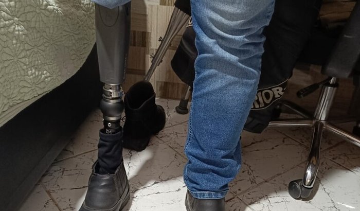 Manutenção da minha prótese 🦿🦿🦿