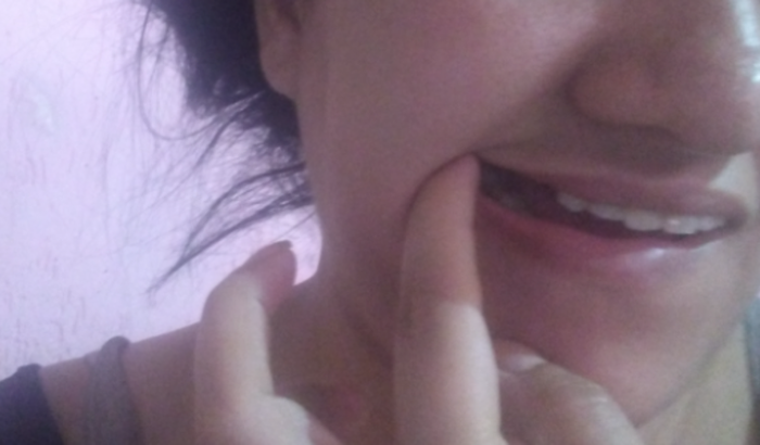 Ajuda arruma meu dente