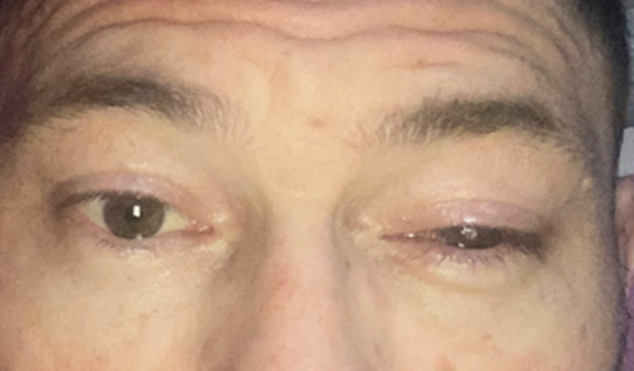 Cirurgia de reparação facial 