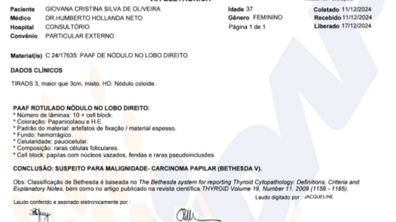 Cirurgia retirada total de Tireóide (CÂNCER) e Pós Operatório 
