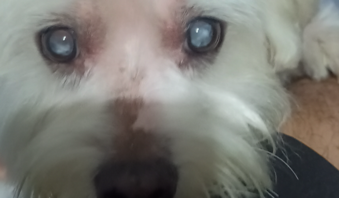 Cirurgia catarata Jhony 