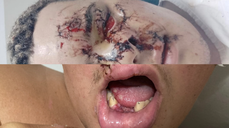 Implante dentário e cirurgia plástica.