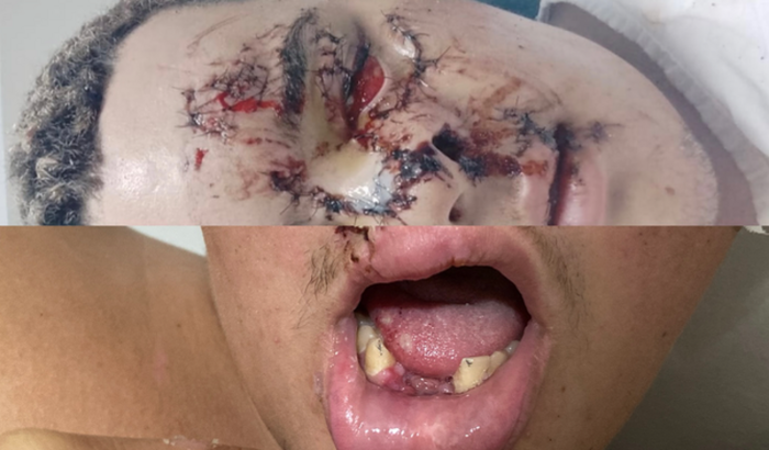 Implante dentário e cirurgia plástica.