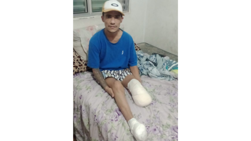 Comprar uma Prótese 