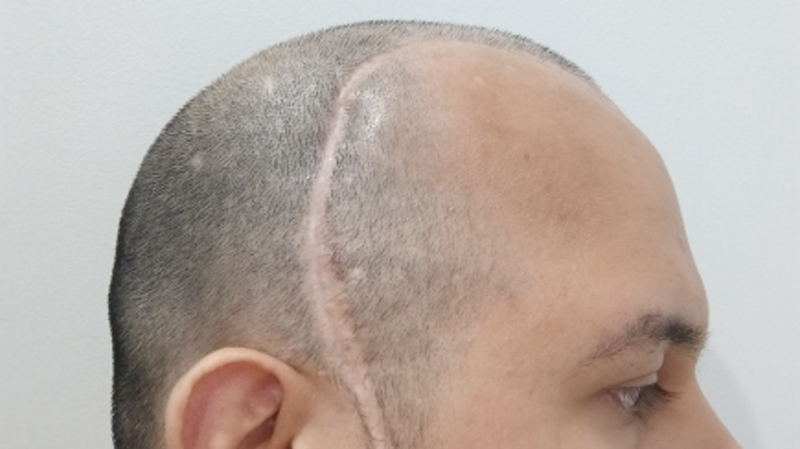 AJUDE AO ALLEX COM A CURA DO SEU CANCÊR!!!