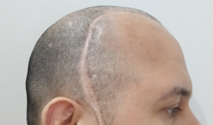 AJUDE AO ALLEX COM A CURA DO SEU CANCÊR!!!