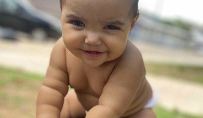 CIRURGIA GLAUCOMA MARIA ALICE