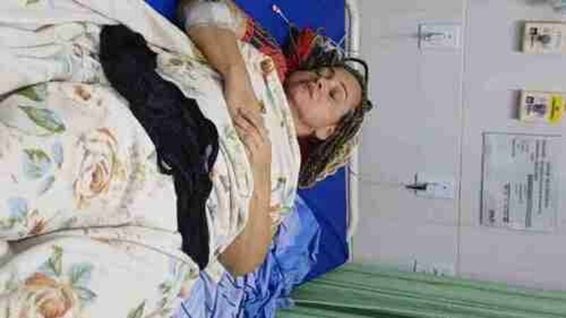 CIRURGIA ARTROPLASTIA TOTAL DE QUADRIL - PRÓTESE DO QUADRIL