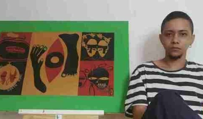 Ginecomastia de Dante 🍀