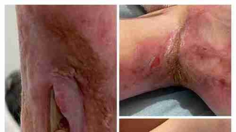 Você pode ajudara família da  Catharina