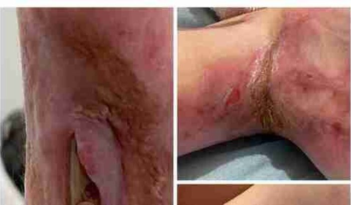 Você pode ajudara família da  Catharina