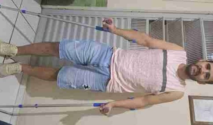 Ajuda para cirurgia de prótese de cabeça de fêmur do Willian