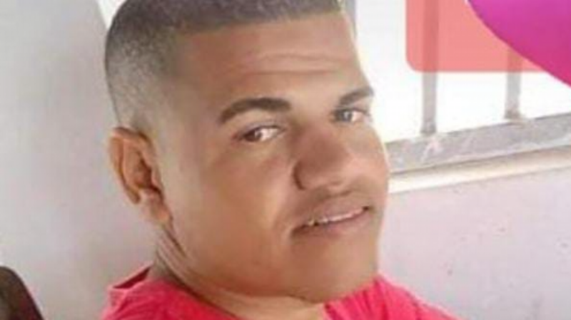 CIRURGIA EM OLHO DIREITO 