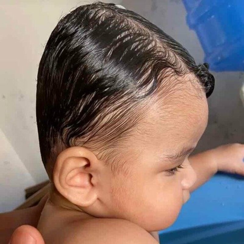 Ajude Heitor Miguel a conseguir sua órtese craniana 