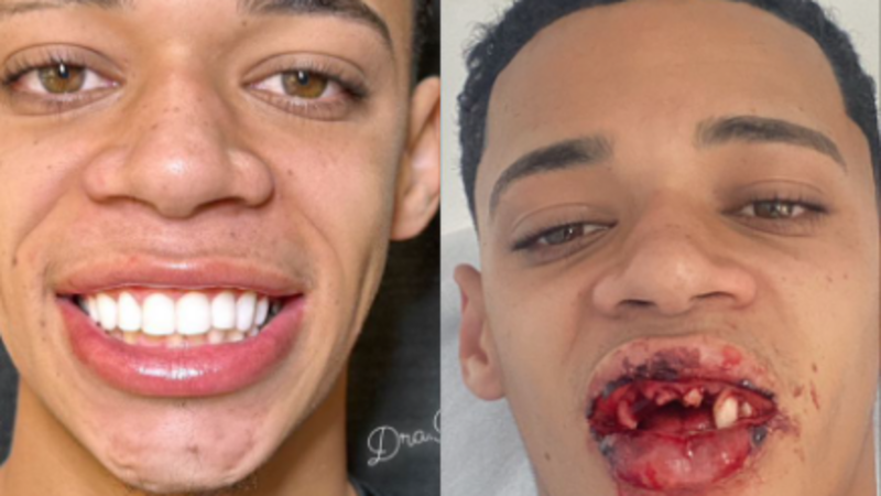 Ajuda para o Pedro Henrique