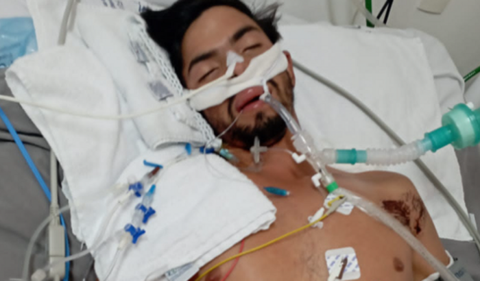 Alessandro sofreu um acidente e tem 4 crianças pequenas