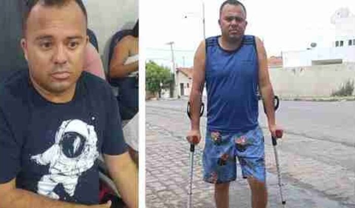 Tratamento de Franciel de Tião Paes