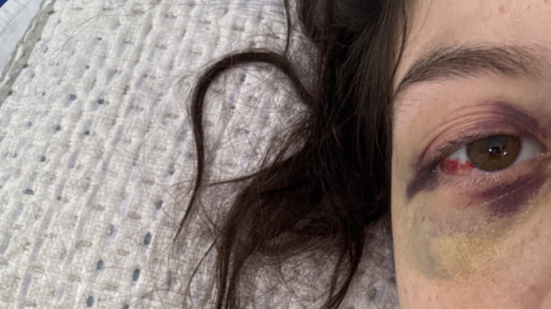 Me ajude nas cirurgias