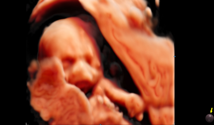 Ajudar para realizar chá de uma amiga