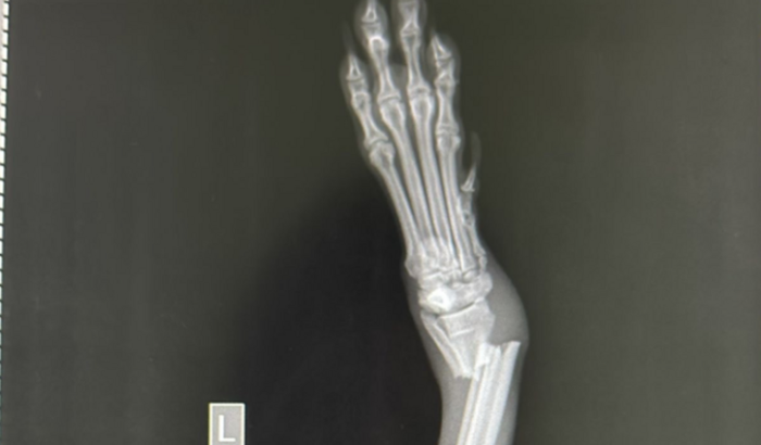 Cirurgia do neguinho