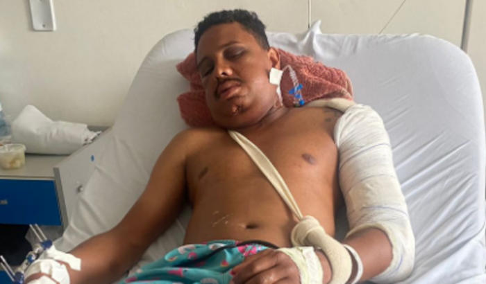 Ajuda Bigode a se recuperar de um acidente