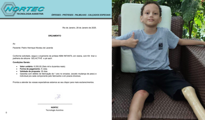 Ajude o Pedrinho a conseguir uma Prótese